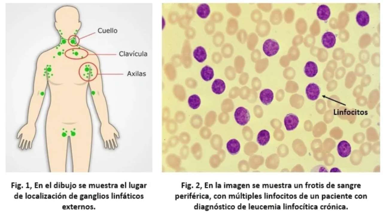 slide22